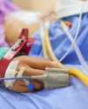 ICU Use for Cardiac Patients Linked to Higher Mortality Rates
