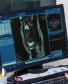 Carequality and RSNA initiative will bring image exchange to the internet