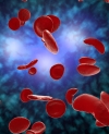 New technology diagnoses sickle cell disease in record time