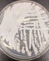 The fungus, called Candida auris, has been detected in a total of 13 hospital patients since May 2013; a CDC report provides details on the first seven cases, which were reported in New York, Illinois, Maryland and New Jersey.