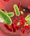 Sepsis Tops Conditions Tracked for Readmission Rates, but Triggers No Penalties
